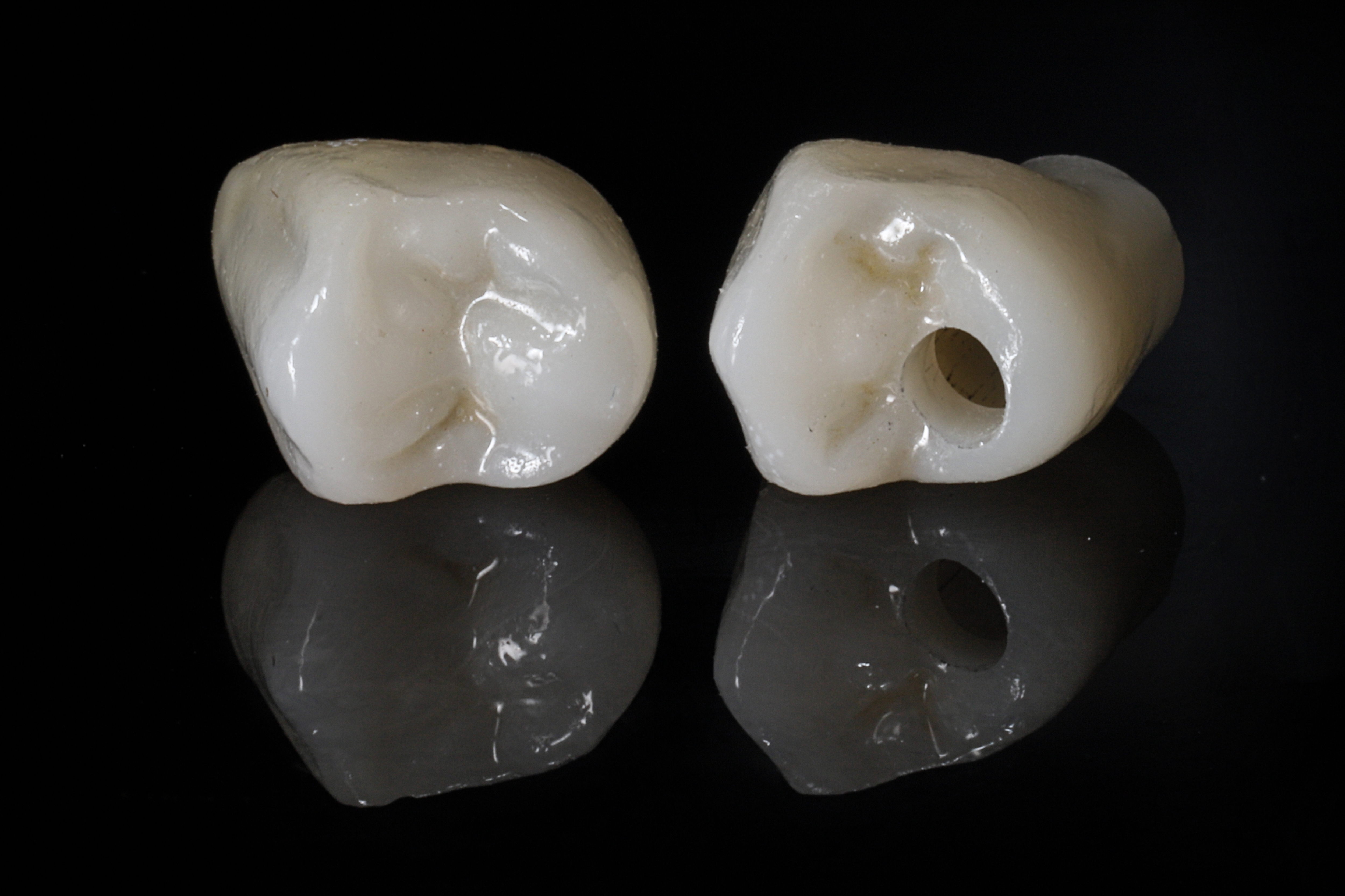 What Is A Dental Crown And When Do You Need One?